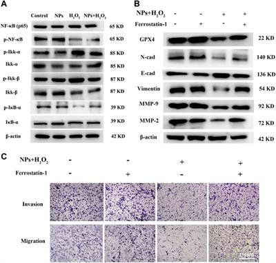 Corrigendum: Yu et al. PPy@Fe3O4 nanoparticles inhibit the proliferation and metastasis of CRC via suppressing the NF-κB signaling pathway and promoting ferroptosis